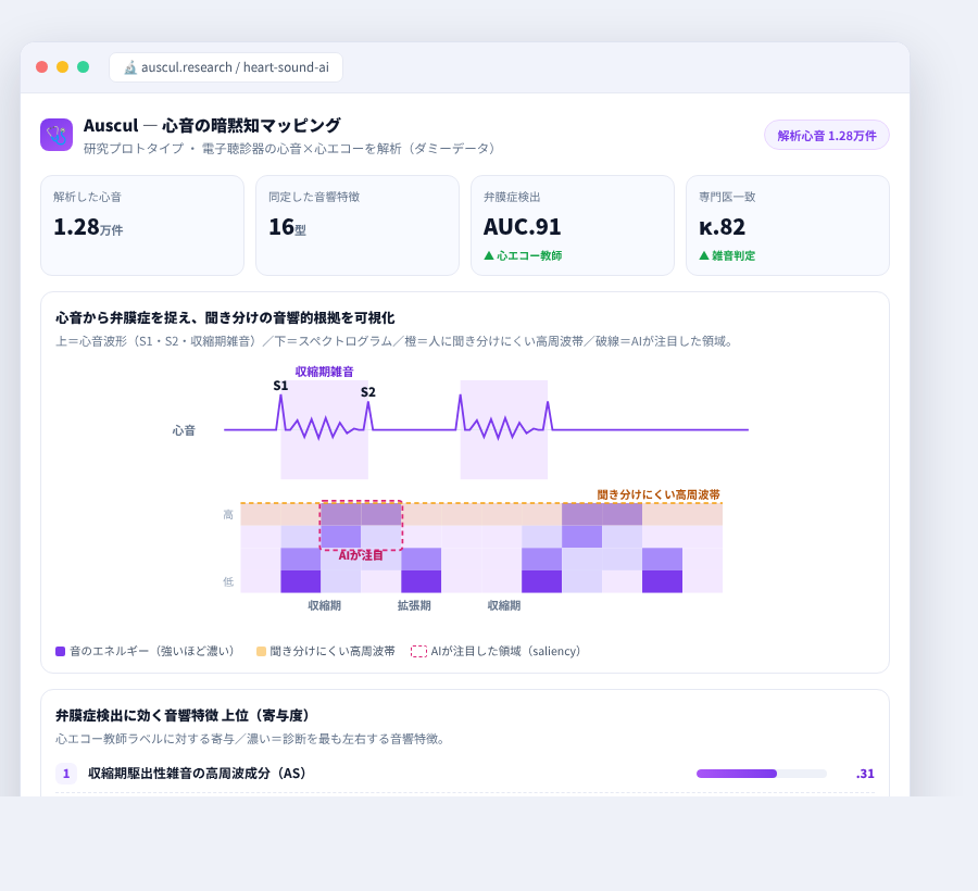 Auscul の完成イメージ