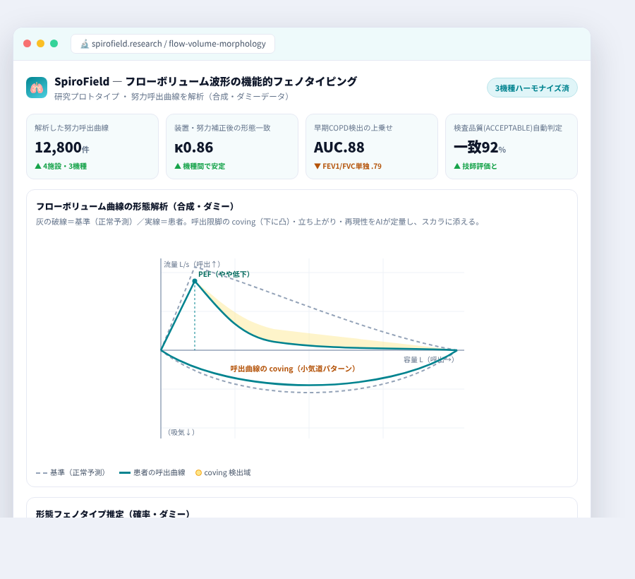 SpiroField の完成イメージ