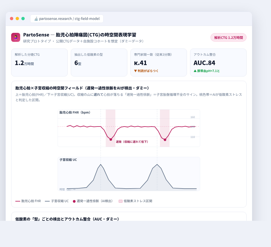 PartoSense の完成イメージ