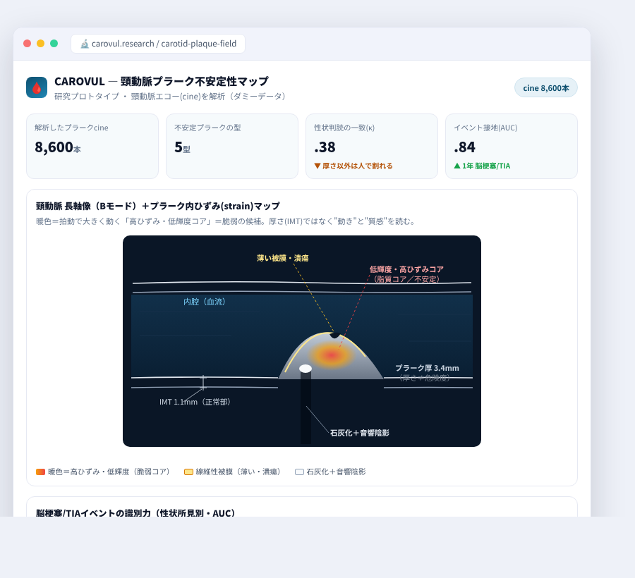 CAROVUL の完成イメージ