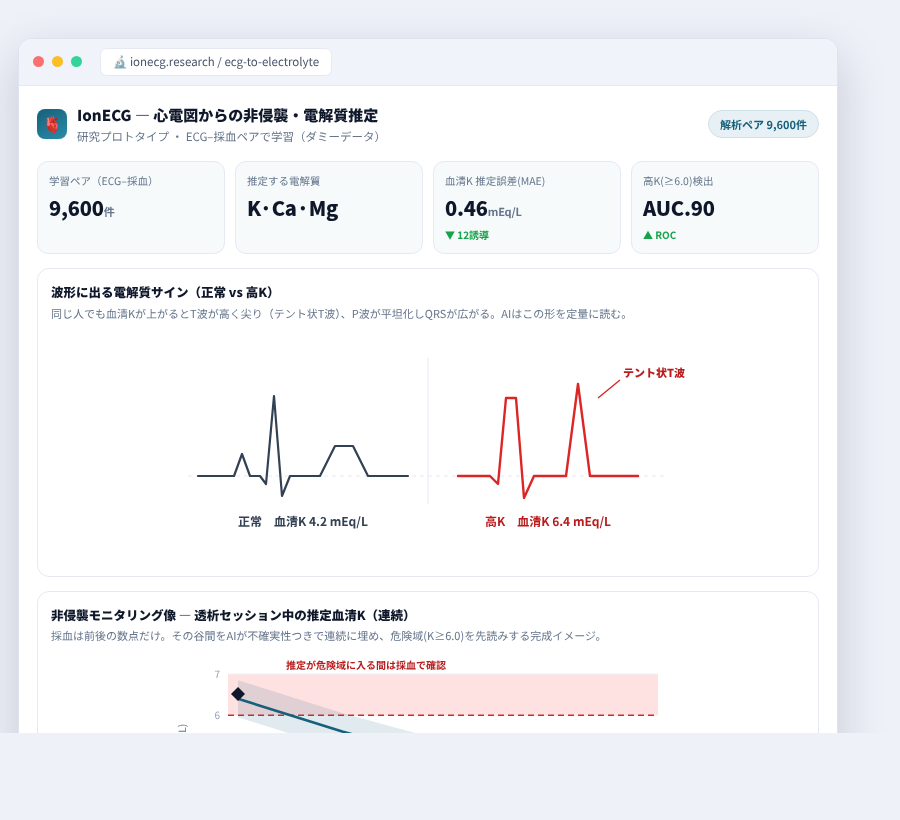 IonECG の完成イメージ
