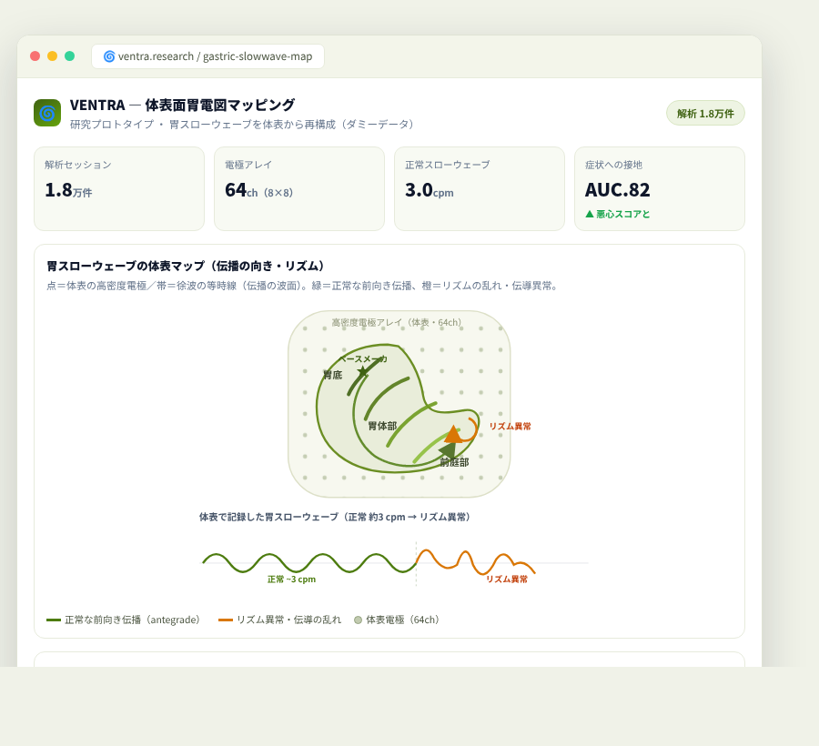 VENTRA の完成イメージ