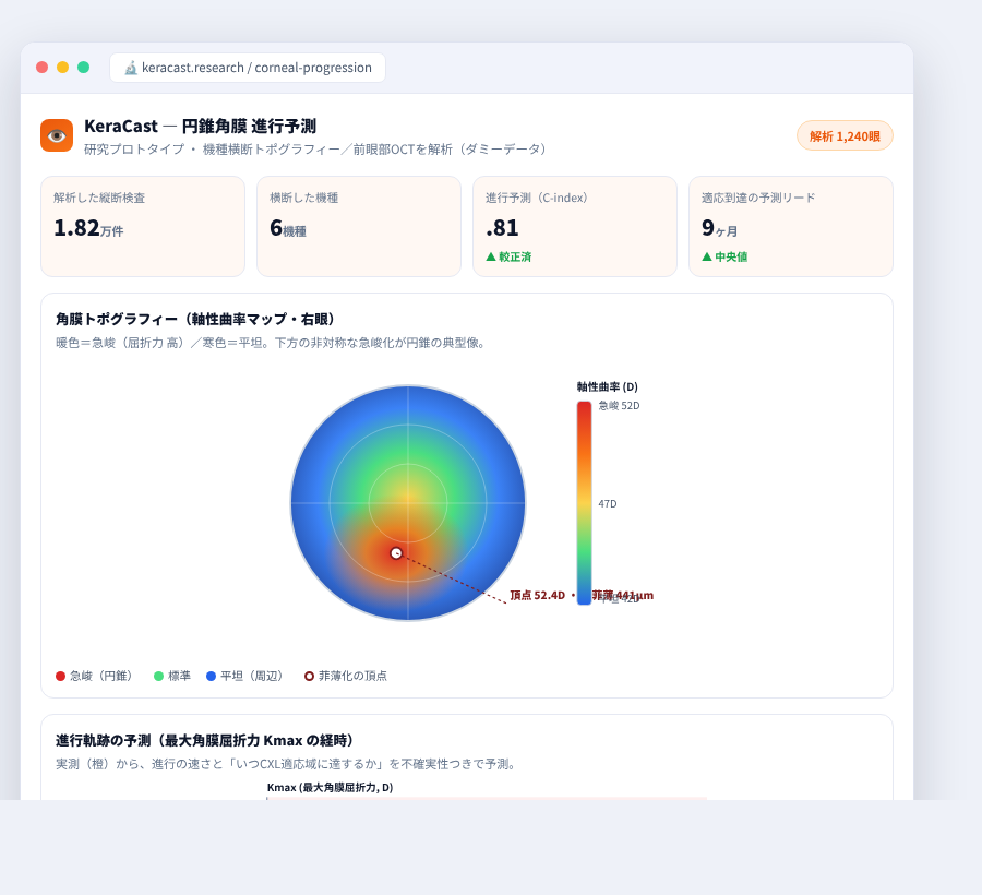 KeraCast の完成イメージ