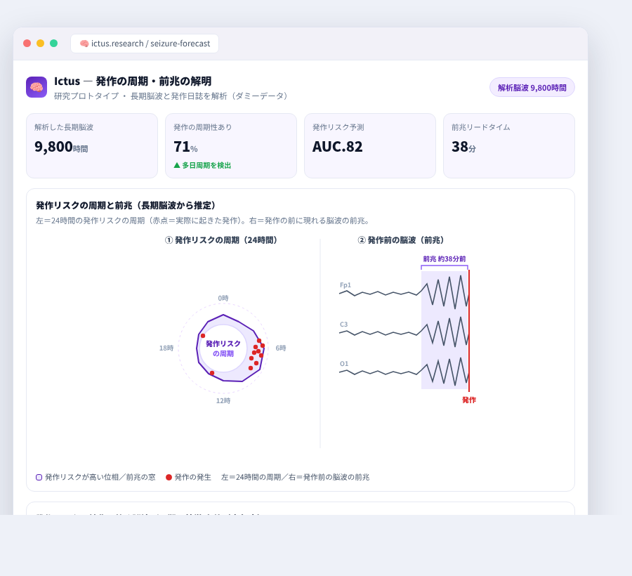 Ictus の完成イメージ