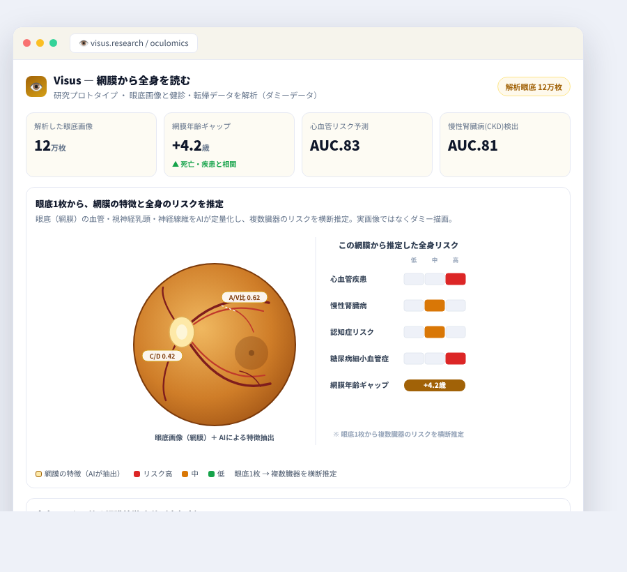 Visus の完成イメージ