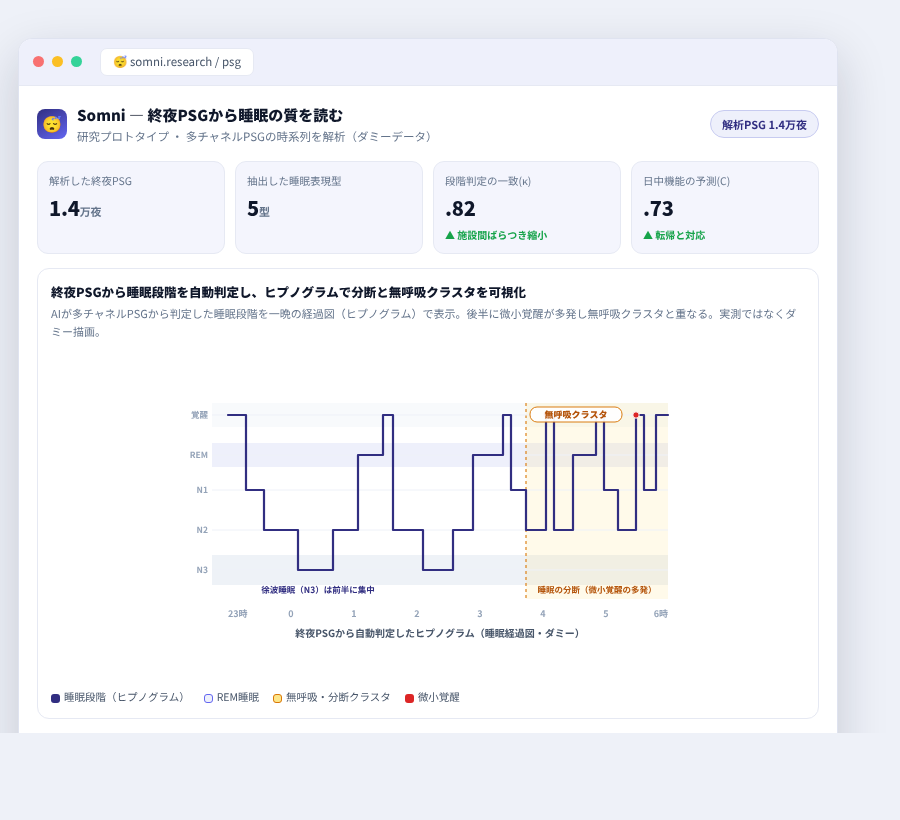 Somni の完成イメージ