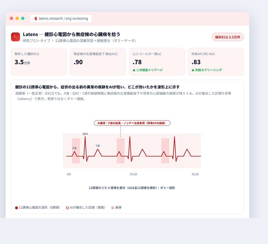 Latens の完成イメージ