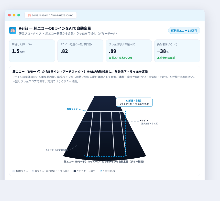 Aeris の完成イメージ