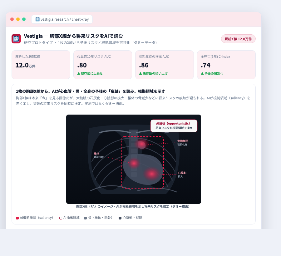 Vestigia の完成イメージ