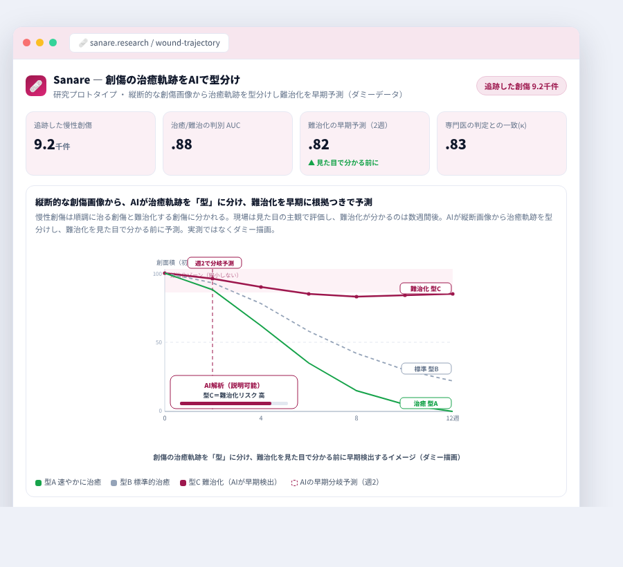 Sanare の完成イメージ