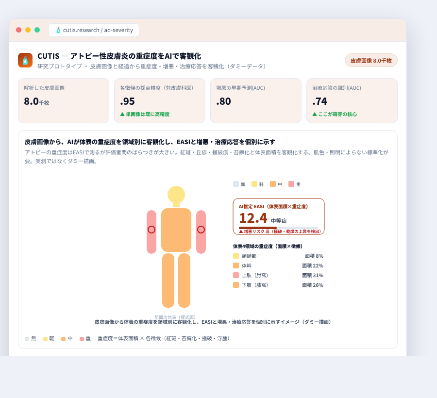 CUTIS の完成イメージ