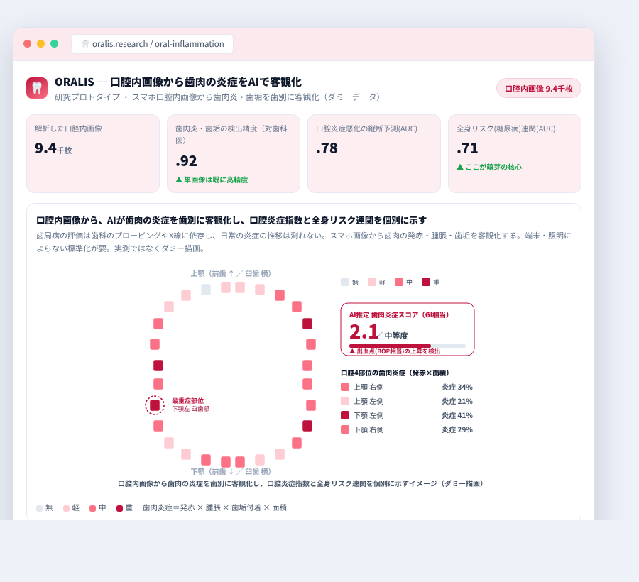 ORALIS の完成イメージ