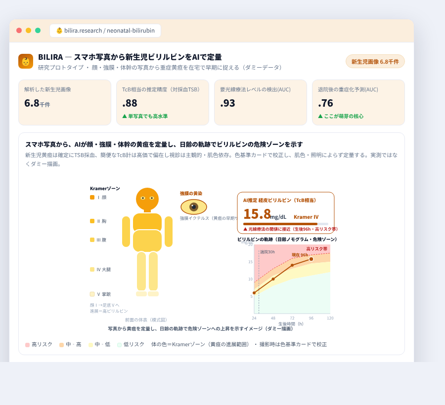 BILIRA の完成イメージ