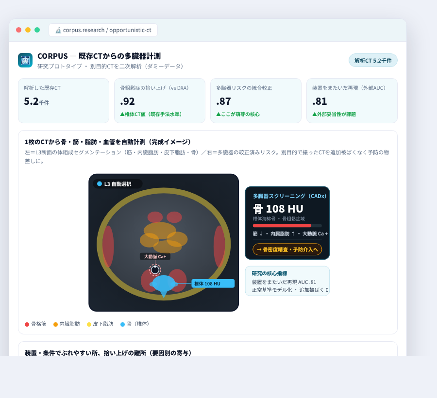 CORPUS の完成イメージ