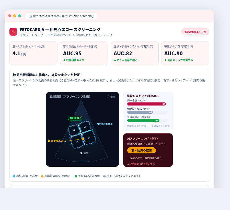 FETOCARDIA の完成イメージ
