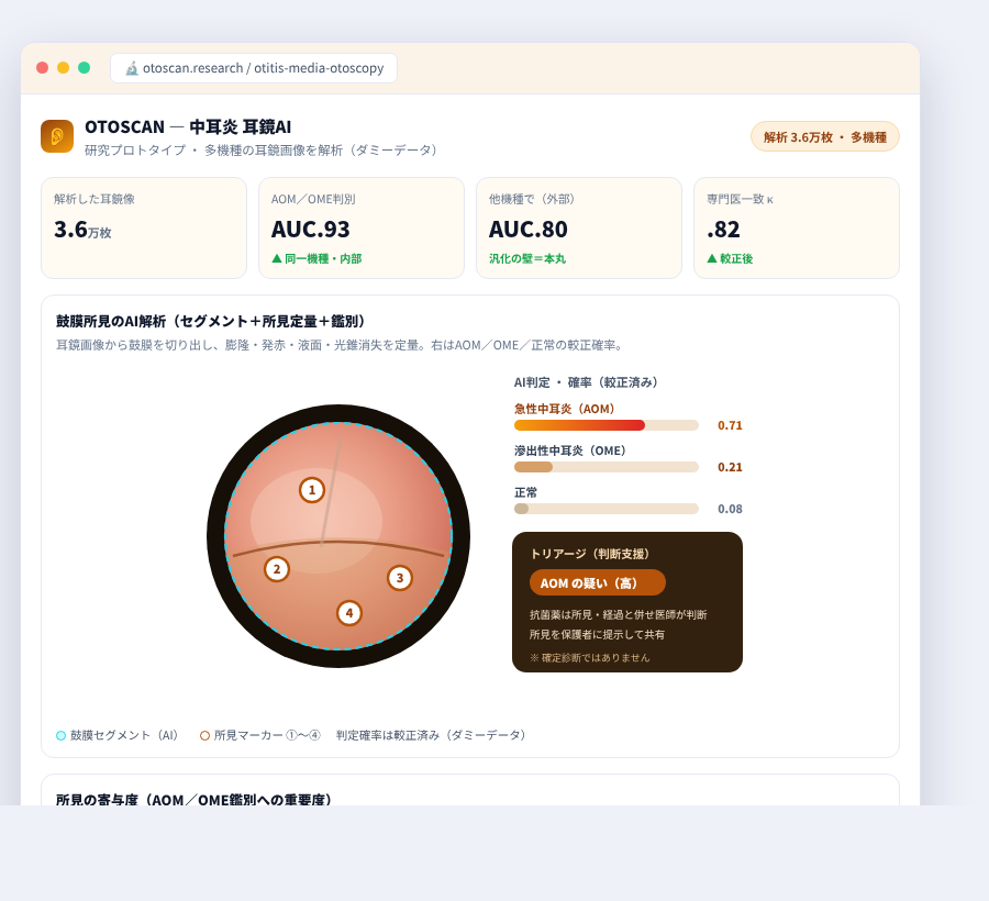 OTOSCAN の完成イメージ