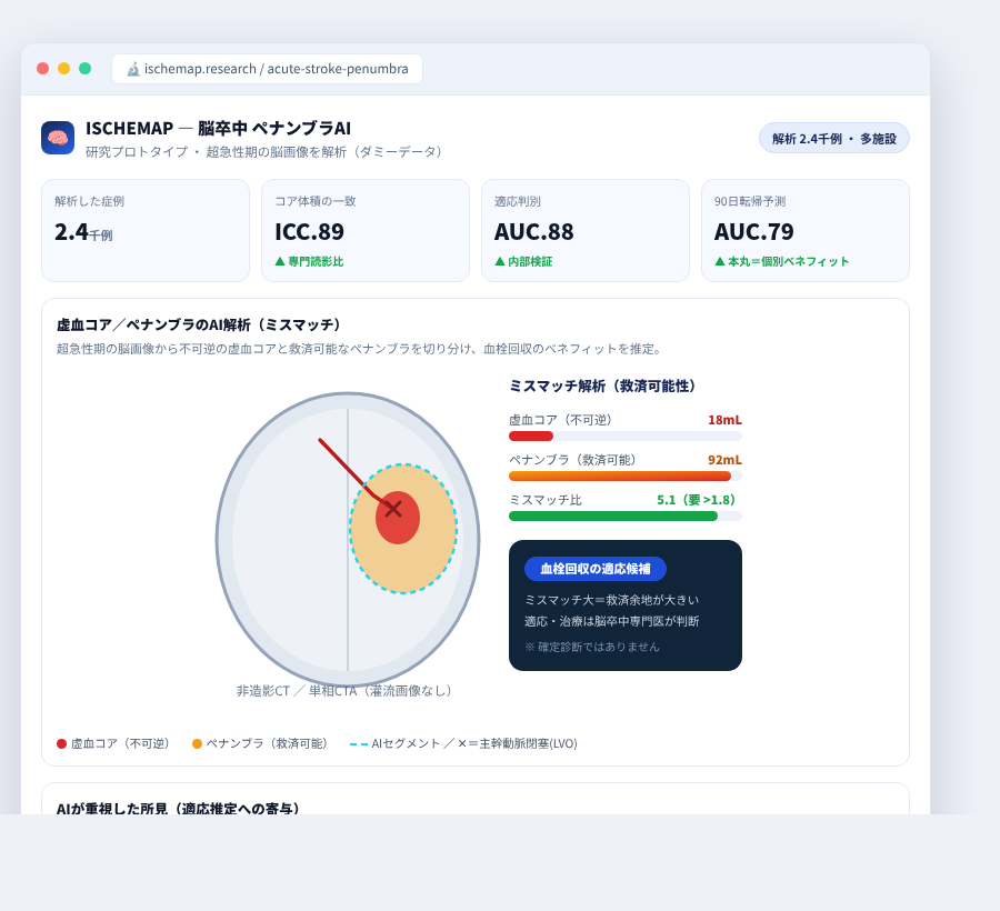 ISCHEMAP の完成イメージ