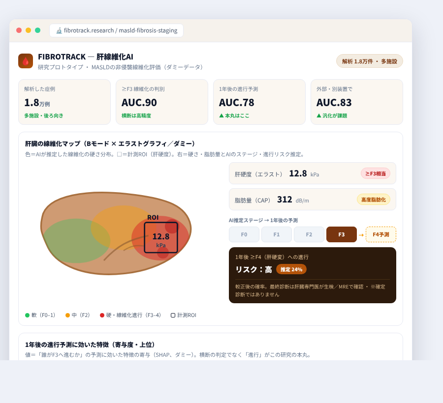 FIBROTRACK の完成イメージ