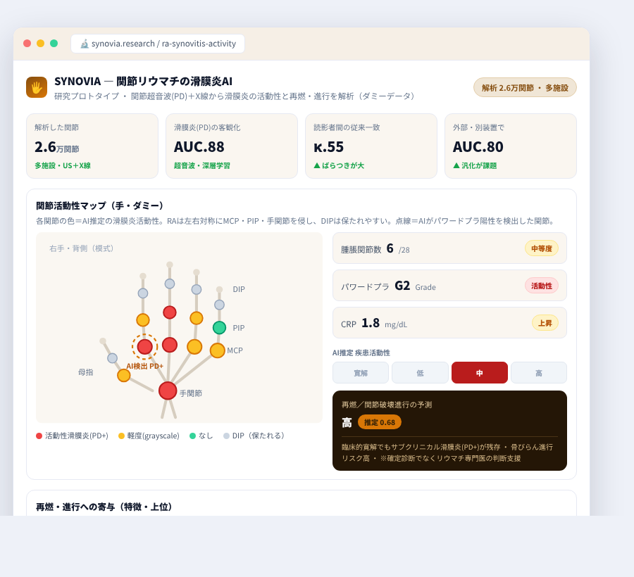 SYNOVIA の完成イメージ