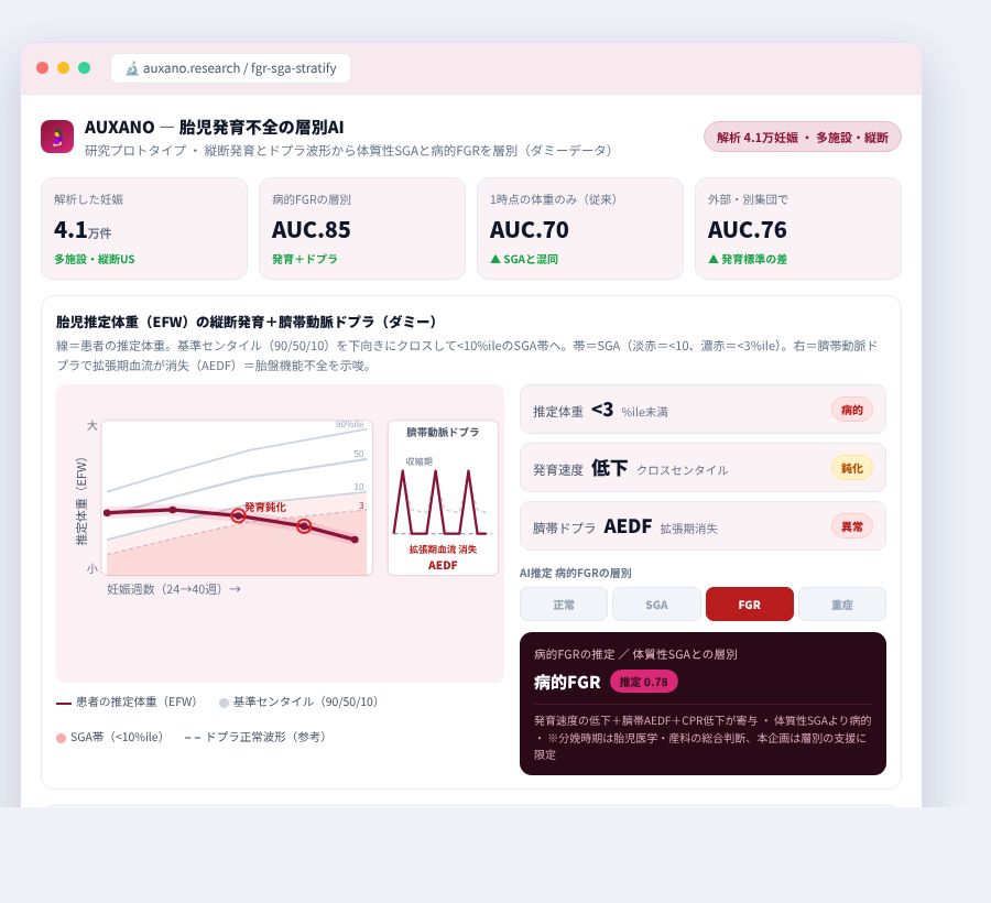 AUXANO の完成イメージ