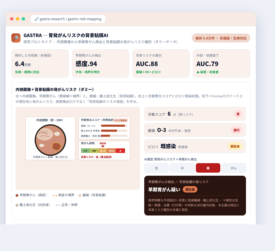 GASTRA の完成イメージ
