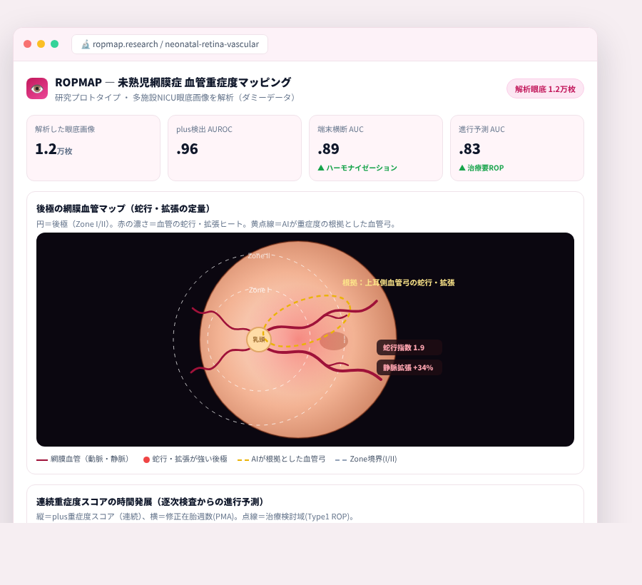 ROPMAP の完成イメージ