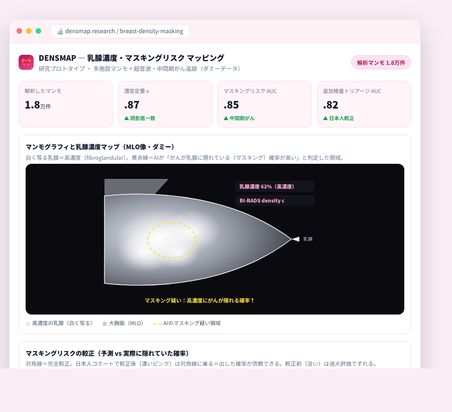 DENSMAP の完成イメージ