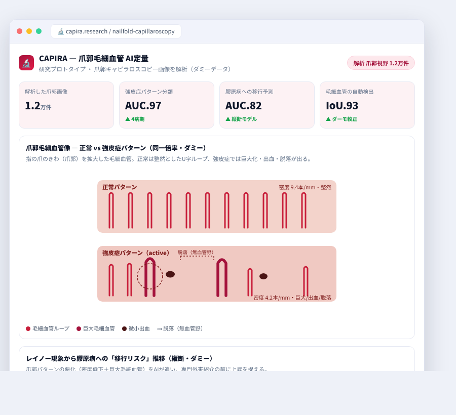 CAPIRA の完成イメージ
