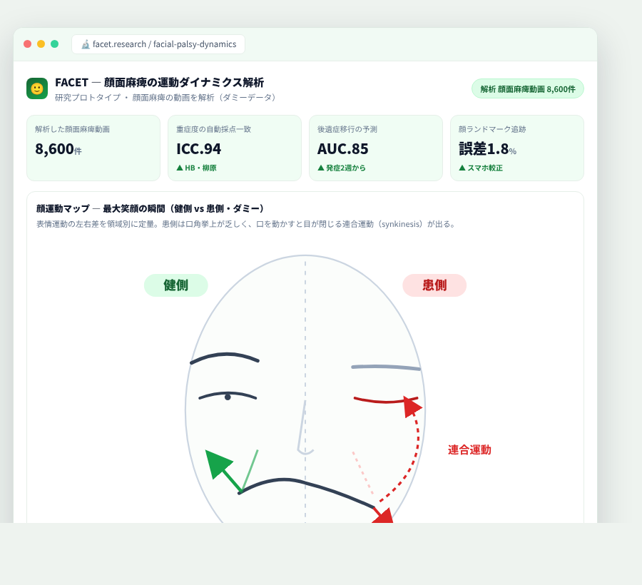 FACET の完成イメージ