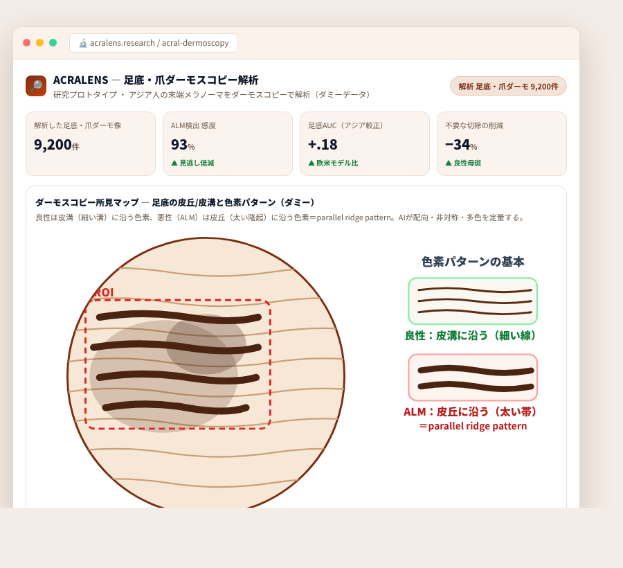 ACRALENS の完成イメージ