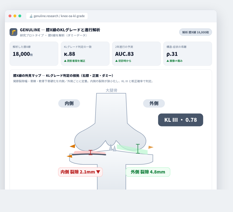 GENULINE の完成イメージ