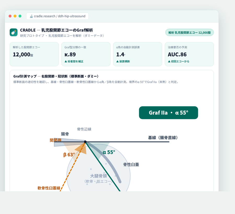 CRADLE の完成イメージ