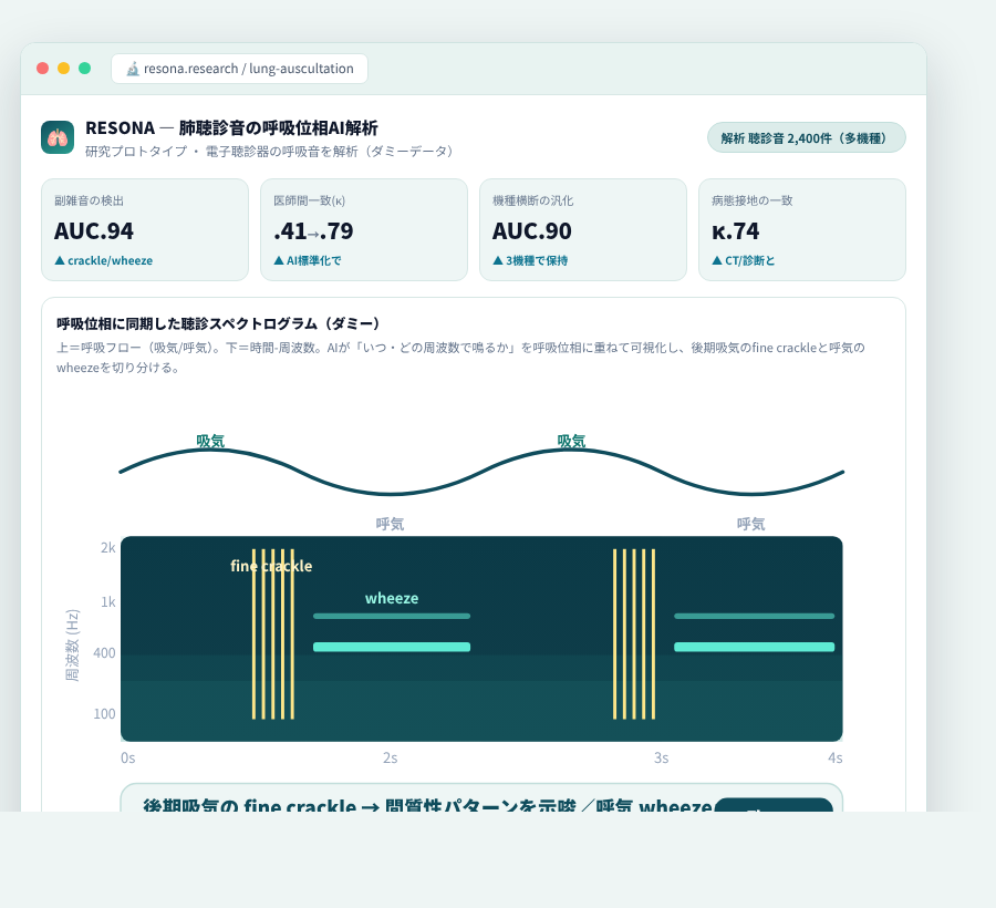 RESONA の完成イメージ