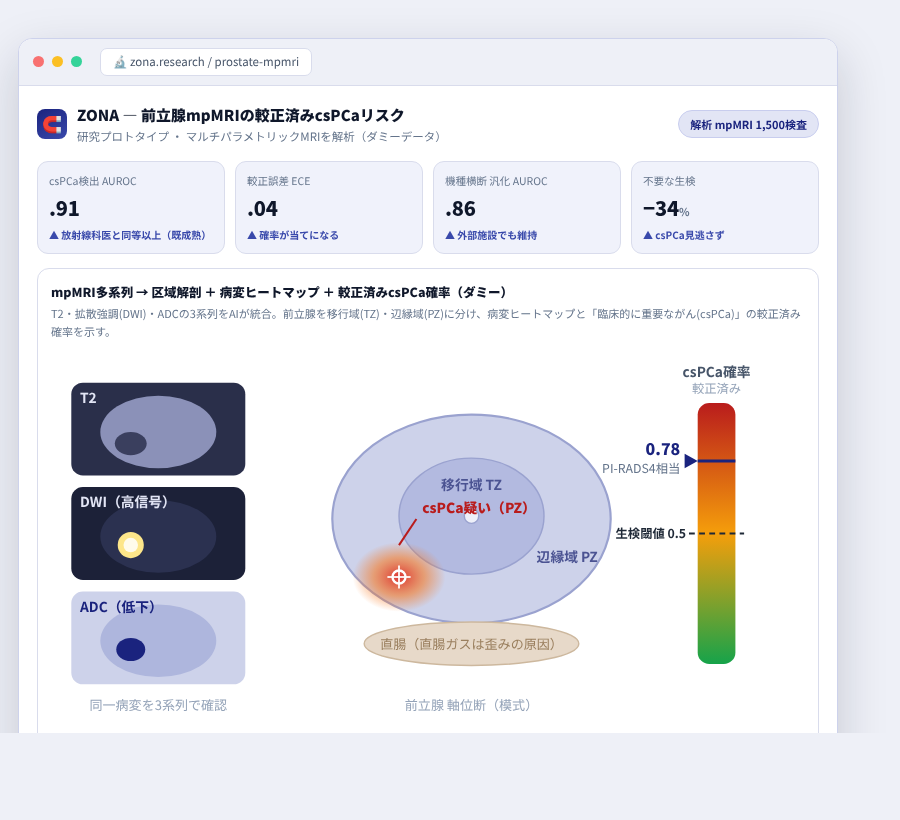 ZONA の完成イメージ