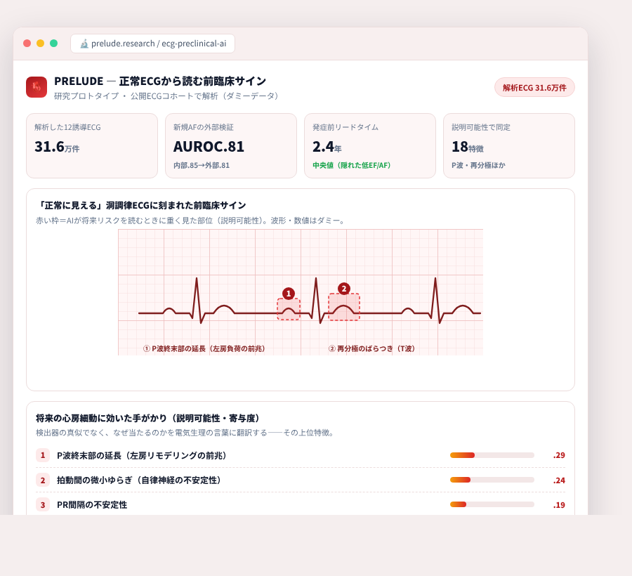 PRELUDE の完成イメージ
