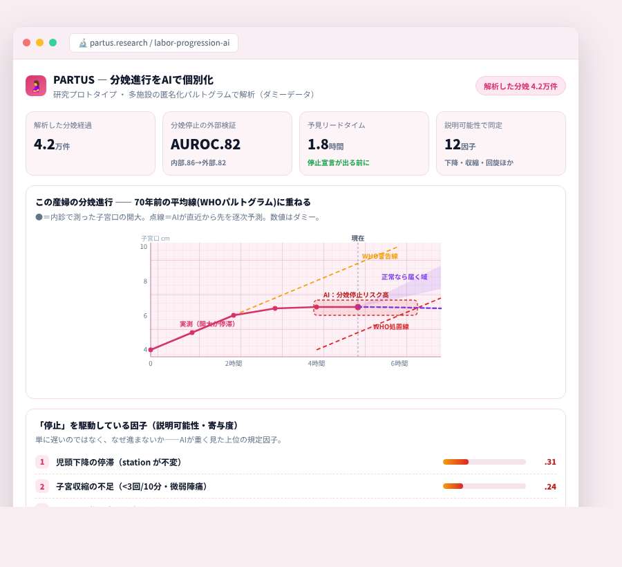 PARTUS の完成イメージ