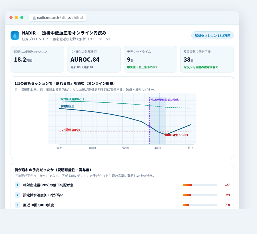 NADIR の完成イメージ