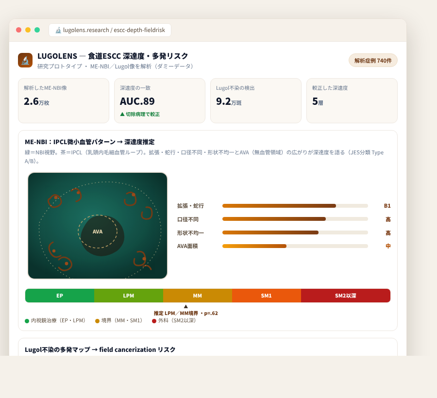 LUGOLENS の完成イメージ
