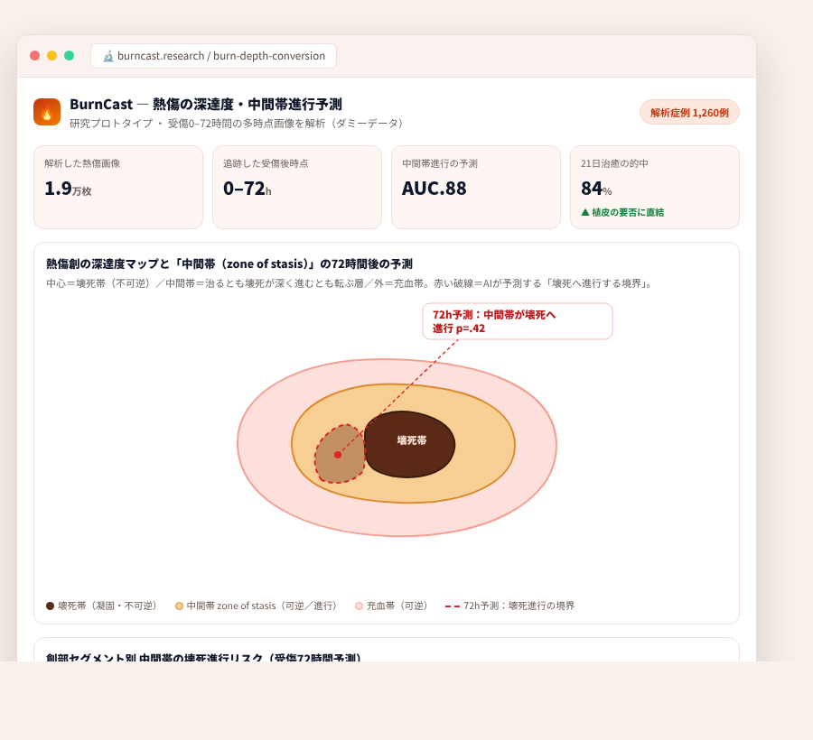 BurnCast の完成イメージ