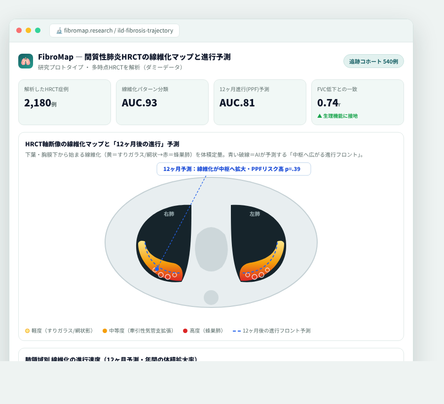 FibroMap の完成イメージ