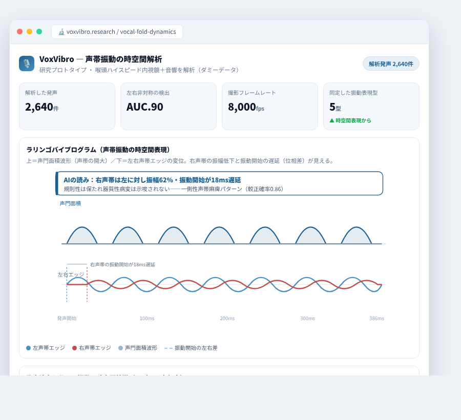 VoxVibro の完成イメージ