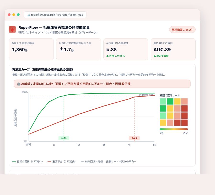 ReperFlow の完成イメージ