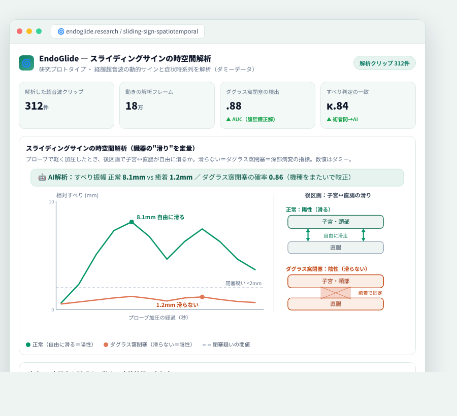 EndoGlide の完成イメージ