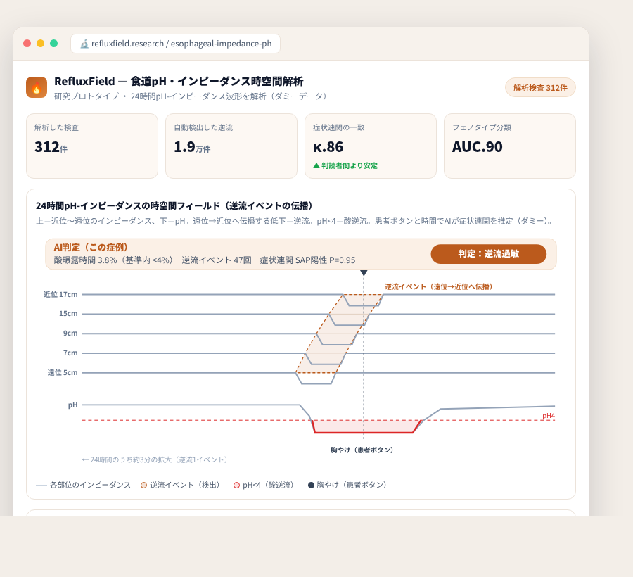 RefluxField の完成イメージ