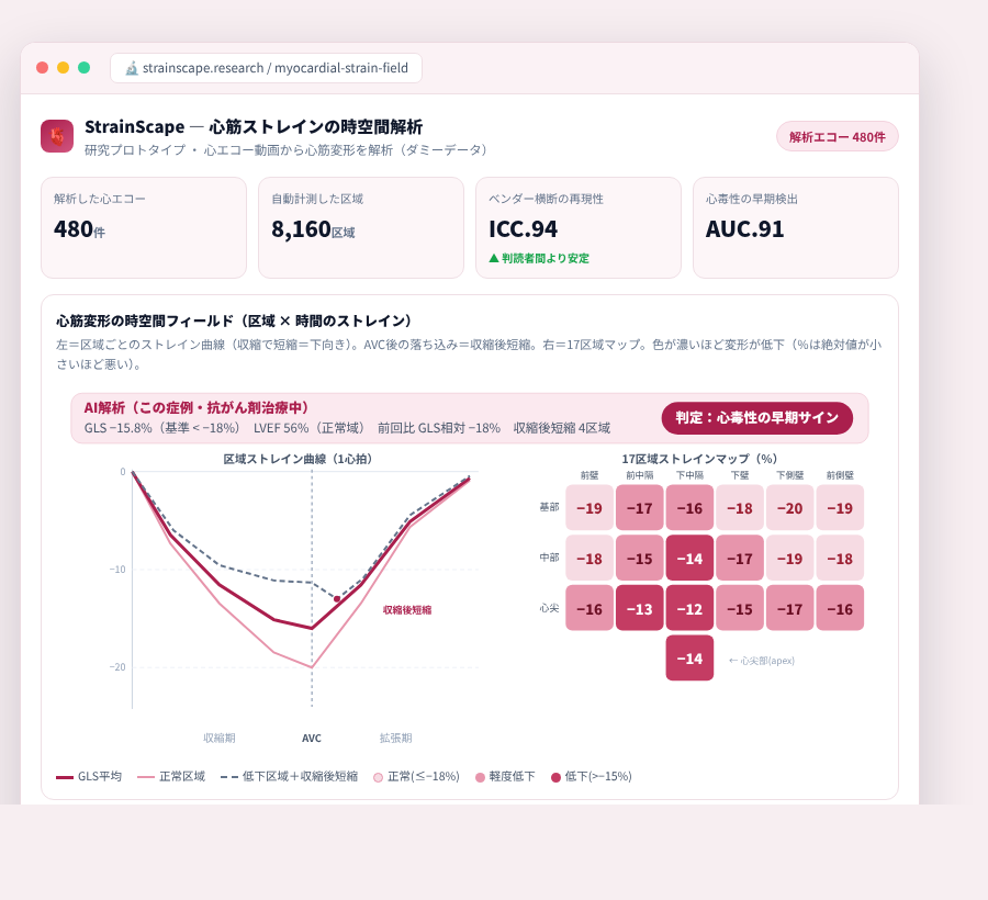 StrainScape の完成イメージ